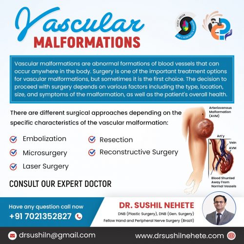 VASCULAR MALFORMATION